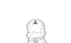 Carl the Cyclops